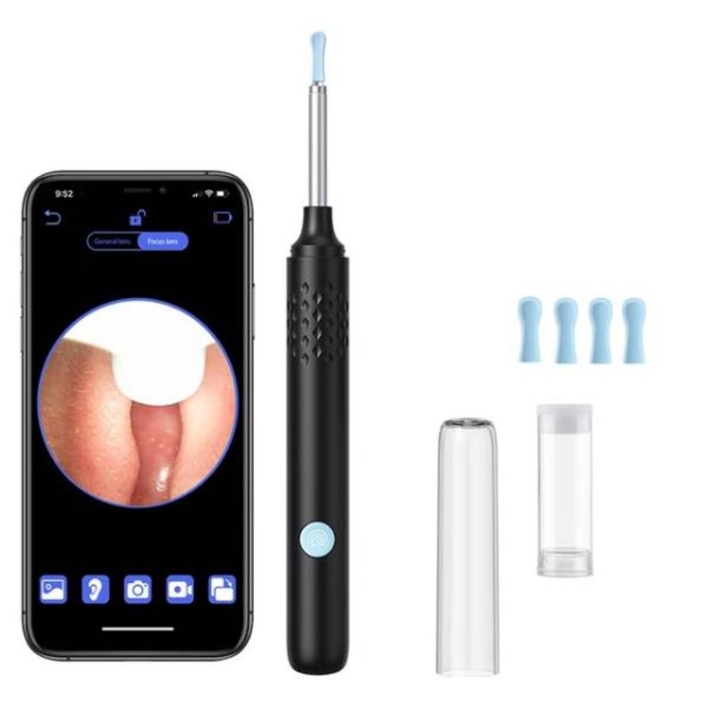 Smart Visual Otoscope - Ear Cleaner